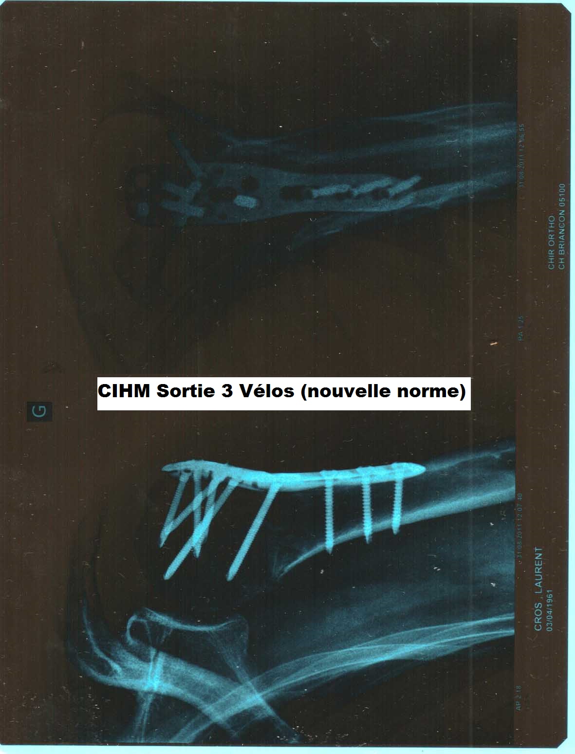 CIHM 3Velos